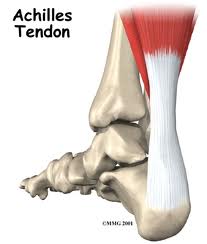 Achilles Tendonitis Treatment in Vancouver