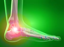 Ankle Pain Treatment in Vancouver