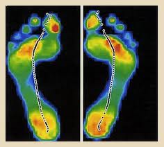 Vancouver Orthotics Gait Scan