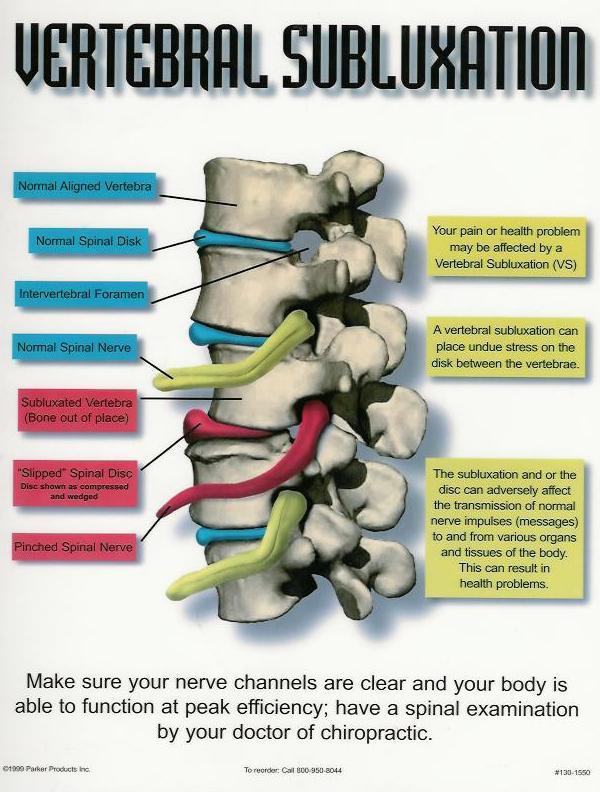 Spinal Neglect, Poor Posture Vancouver